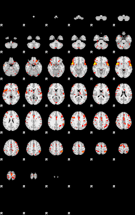 Patient:61;component:113