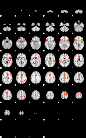 Patient:61;component:125