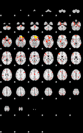 Patient:61;component:144