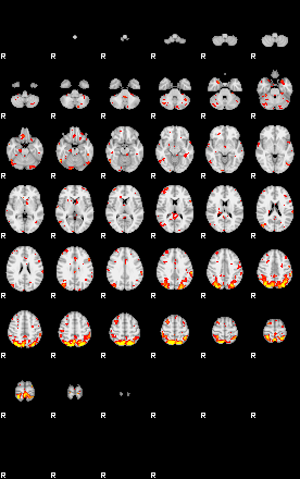 Patient:61;component:148