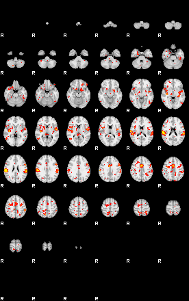 Patient:61;component:150