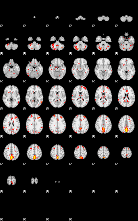 Patient:61;component:154