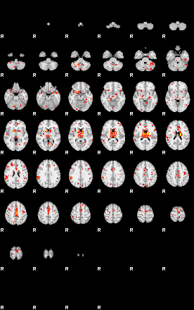 Patient:61;component:174