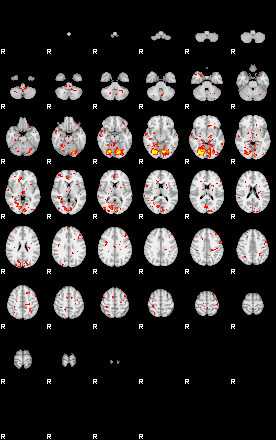 Patient:61;component:191