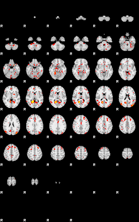 Patient:61;component:29