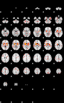 Patient:61;component:39