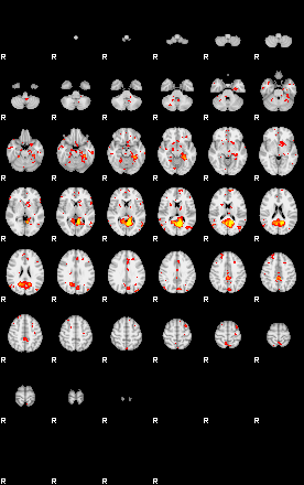 Patient:61;component:54