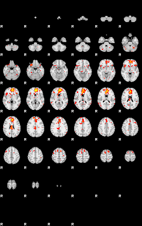 Patient:62;component:125