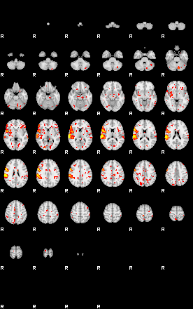 Patient:62;component:150