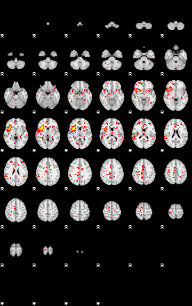 Patient:62;component:151