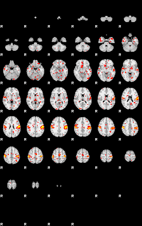 Patient:62;component:21