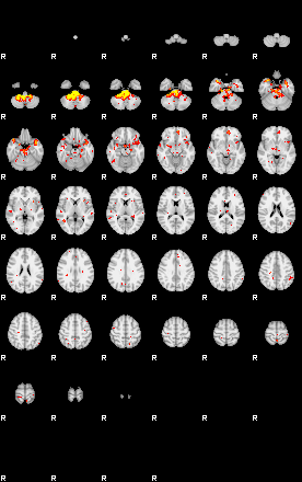 Patient:62;component:32