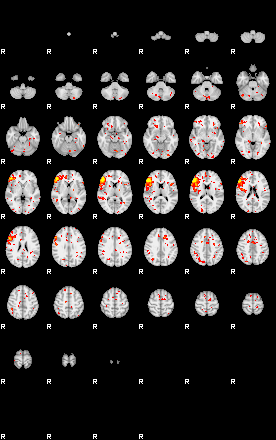 Patient:62;component:6