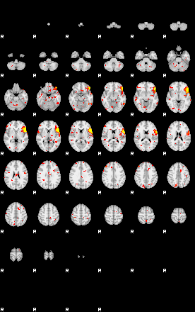 Patient:62;component:94