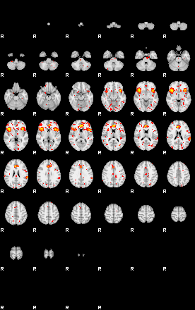 Patient:63;component:125