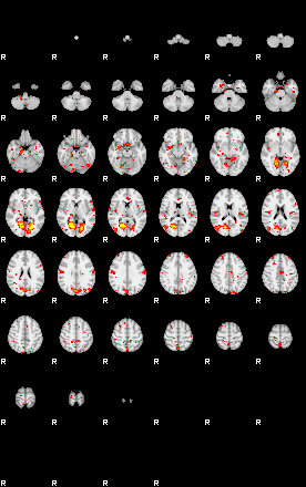 Patient:63;component:29