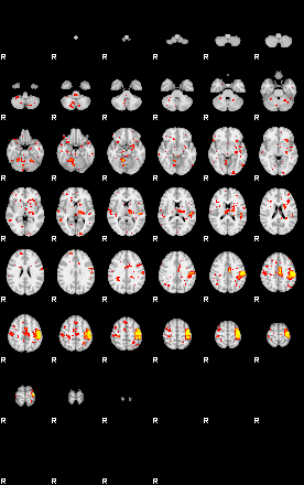 Patient:64;component:101