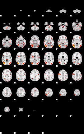 Patient:64;component:143