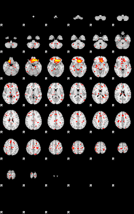 Patient:64;component:144