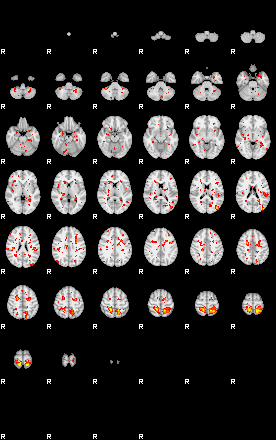 Patient:64;component:55