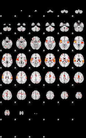 Patient:64;component:58