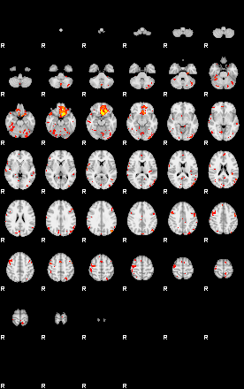 Patient:65;component:144