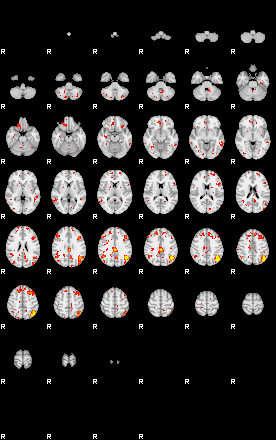 Patient:65;component:180