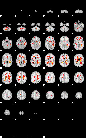 Patient:65;component:183