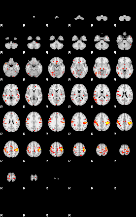 Patient:65;component:21