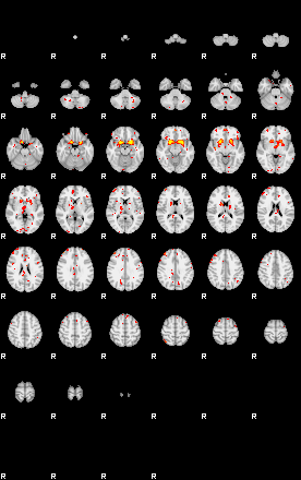 Patient:65;component:4