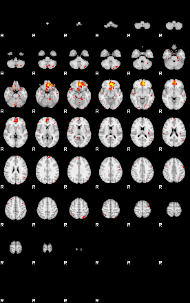 Patient:65;component:43