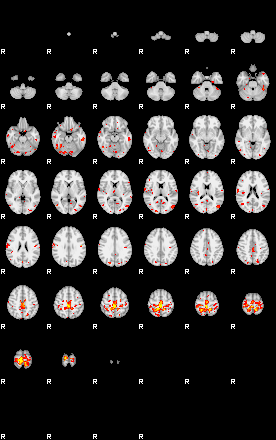 Patient:65;component:55