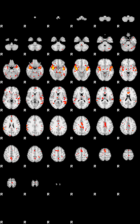 Patient:66;component:11