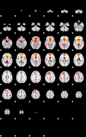 Patient:66;component:49