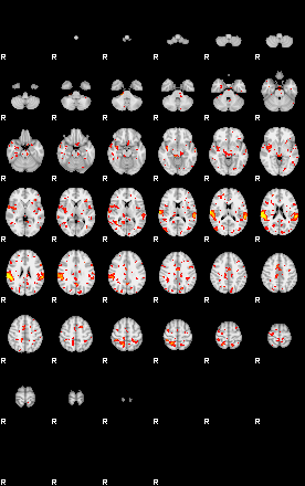 Patient:67;component:150