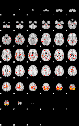 Patient:67;component:55