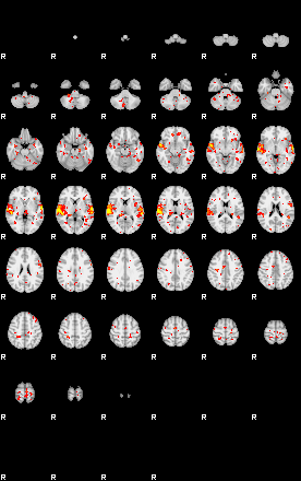 Patient:67;component:87