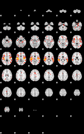 Patient:68;component:90