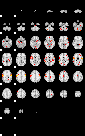 Patient:68;component:96