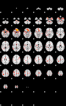 Patient:69;component:113