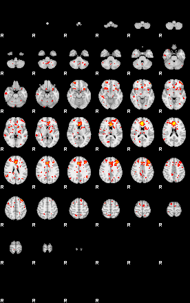 Patient:69;component:125