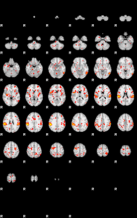 Patient:69;component:150