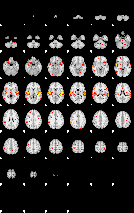 Patient:69;component:158