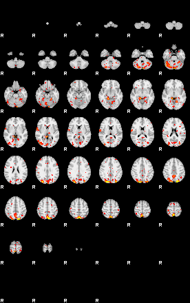 Patient:69;component:18