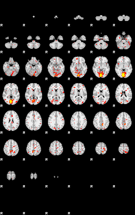 Patient:69;component:30