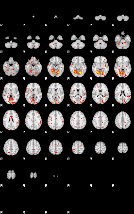 Patient:70;component:126