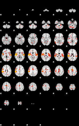 Patient:70;component:150