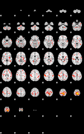 Patient:71;component:55