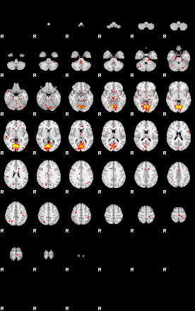 Patient:72;component:191