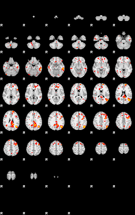 Patient:72;component:93